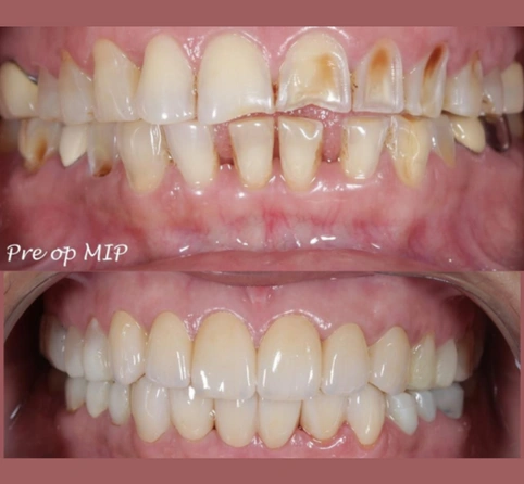 Stop suffering from painful toothaches and mouth sores any longer!