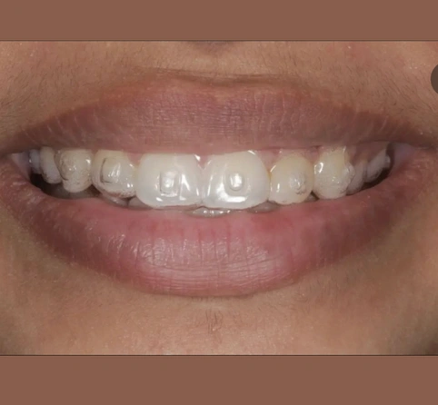 Orthodontics in Koparkhairane for Healthier Smiles